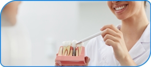 Implant Dentist Near Me in Norwalk, CA Implant Dentist Near Me in Norwalk, CA