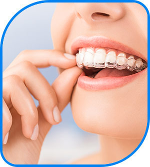 Invisible Braces Near Me in Norwalk, CA