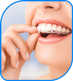 Invisible Braces Near Me in Norwalk, CA