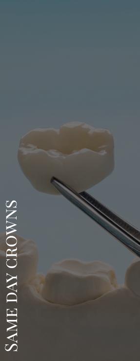 Dental Crowns Near Me in Norwalk, CA Dental Crowns Near Me in Norwalk, CA