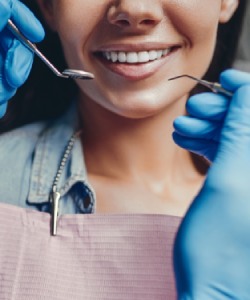 Dental Fillings Near Me in Norwalk, CA