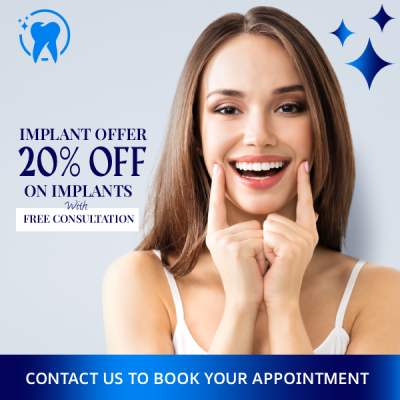 Implant Offer - 20% Off on Implants with Free Consultation - Rosecrans Square Dental Clinic in Norwalk, CA