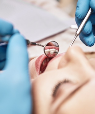 Oral Cancer Screening in Norwalk, CA