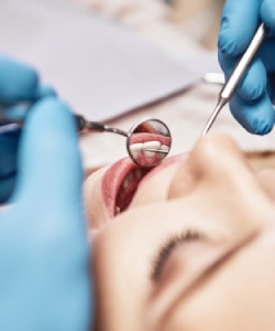 Oral Cancer Screening in Norwalk, CA